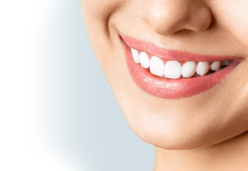 Teeth Whitening in Bromley 1