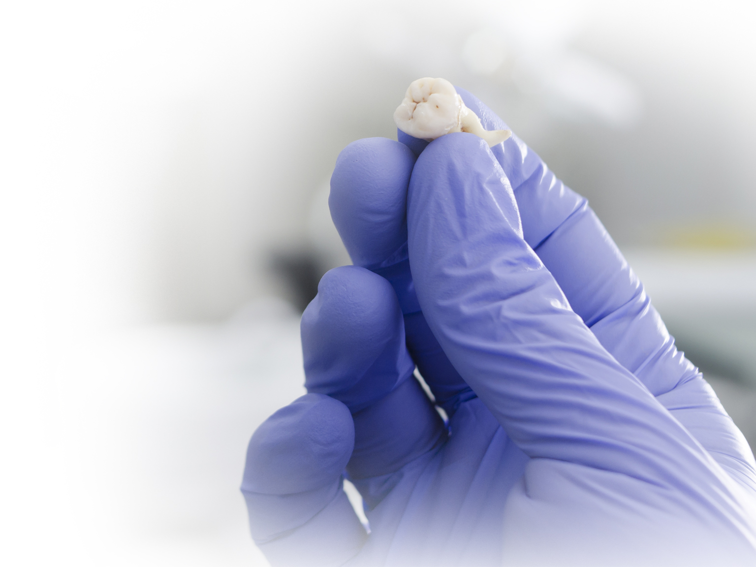 Surgical Extractions 2