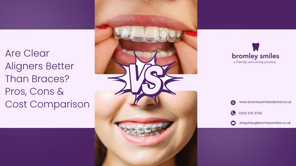 Are Clear Aligners Better Than Braces in Bromley? Pros, Cons and Cost Comparison Guide