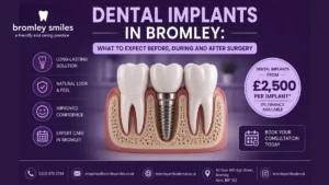Dental implants in Bromley designed for natural smile restoration and secure permanent tooth replacement.