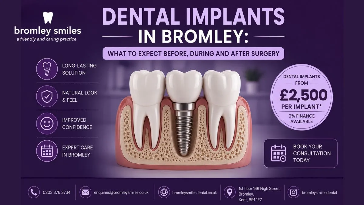 Dental implants in Bromley designed for natural smile restoration and secure permanent tooth replacement.
