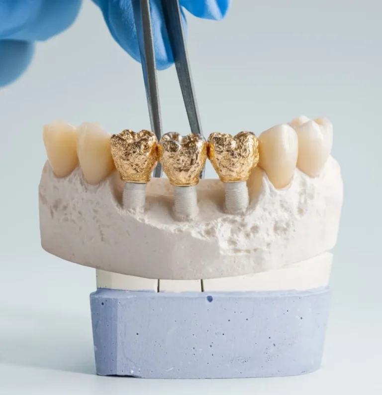 bromley-smiles-dental-denta-crowns-in-general-dentistry