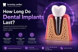 how long do dental implants last bromley smiles