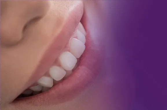 smile-makeover
