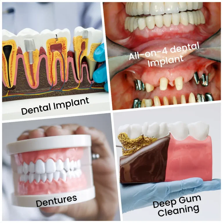 Specialist dentistry including dental implants near Bickley